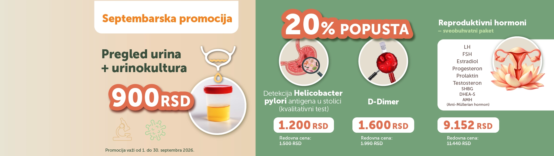 Septembarska promocija: pregled urina i urinokultura za 900 RSD (promo 1.–30.9.2026).